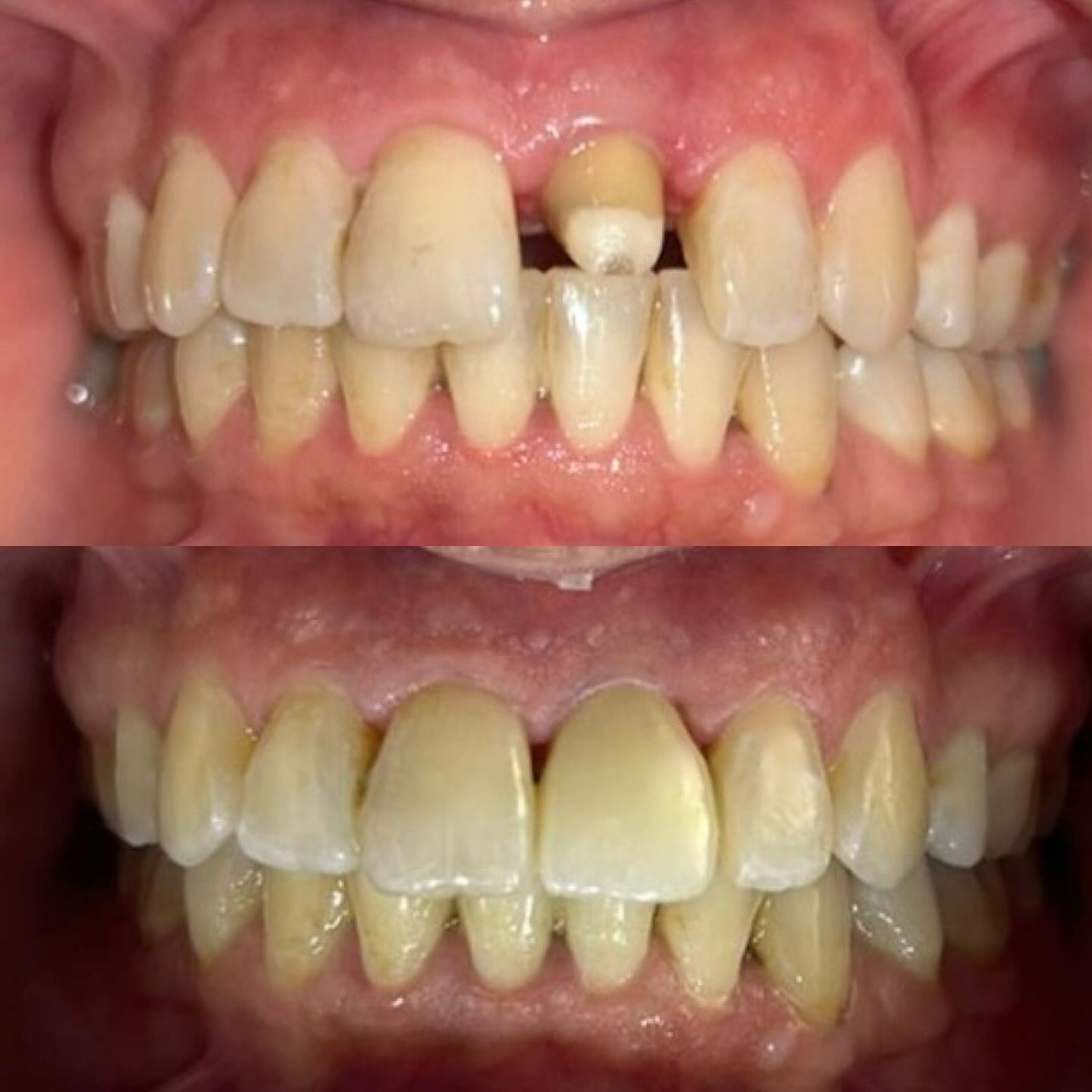 Transformation 1