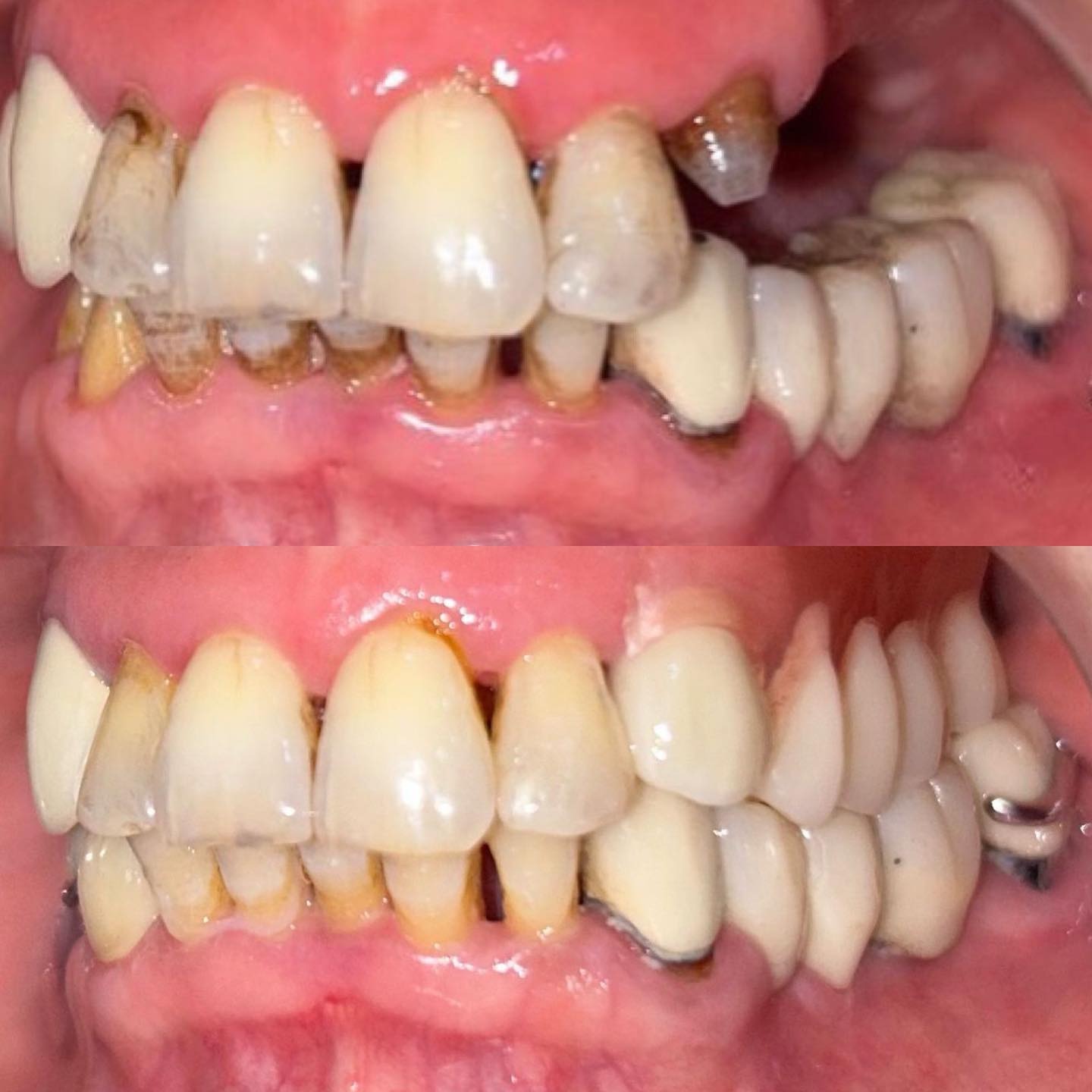 Transformation 4