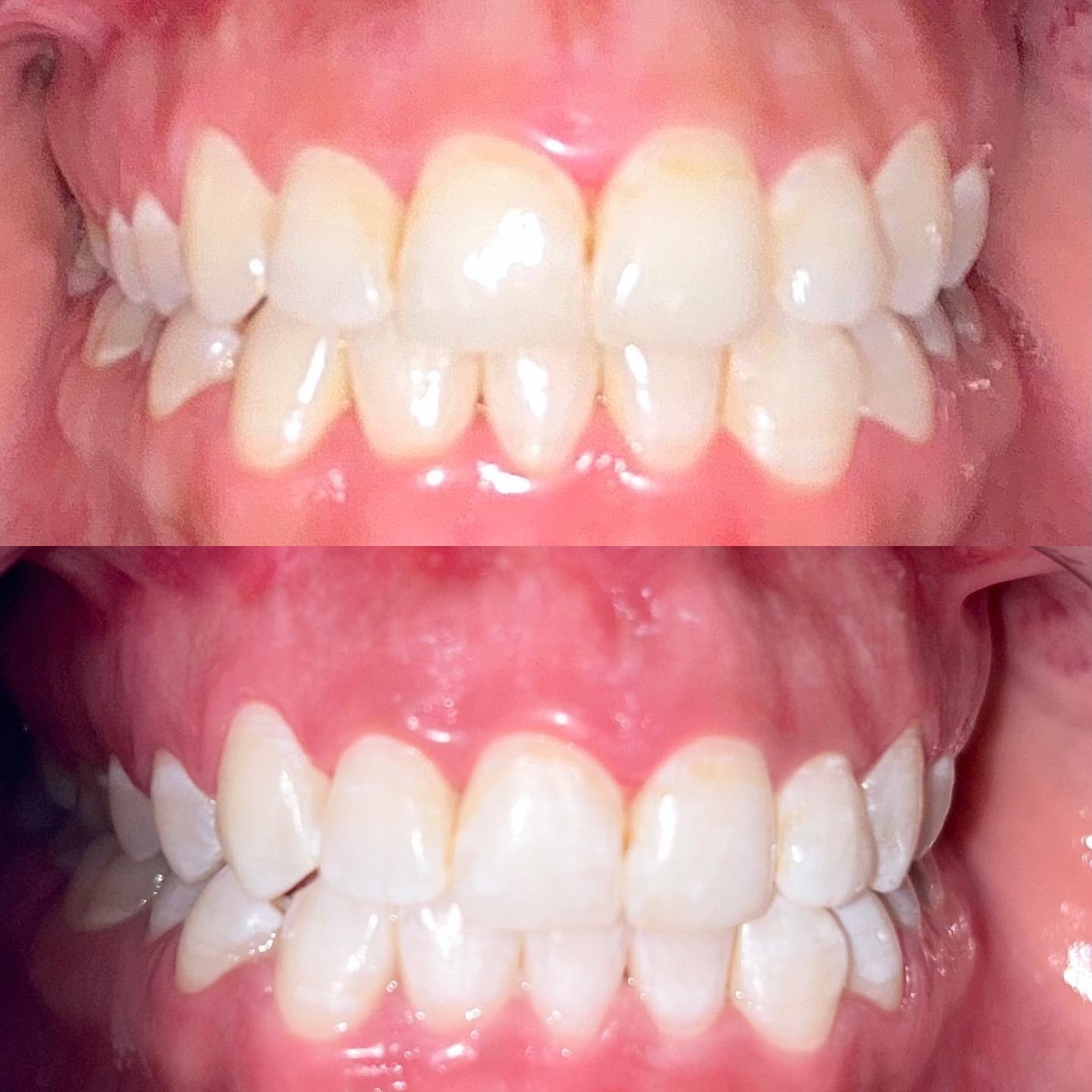 Transformation 5