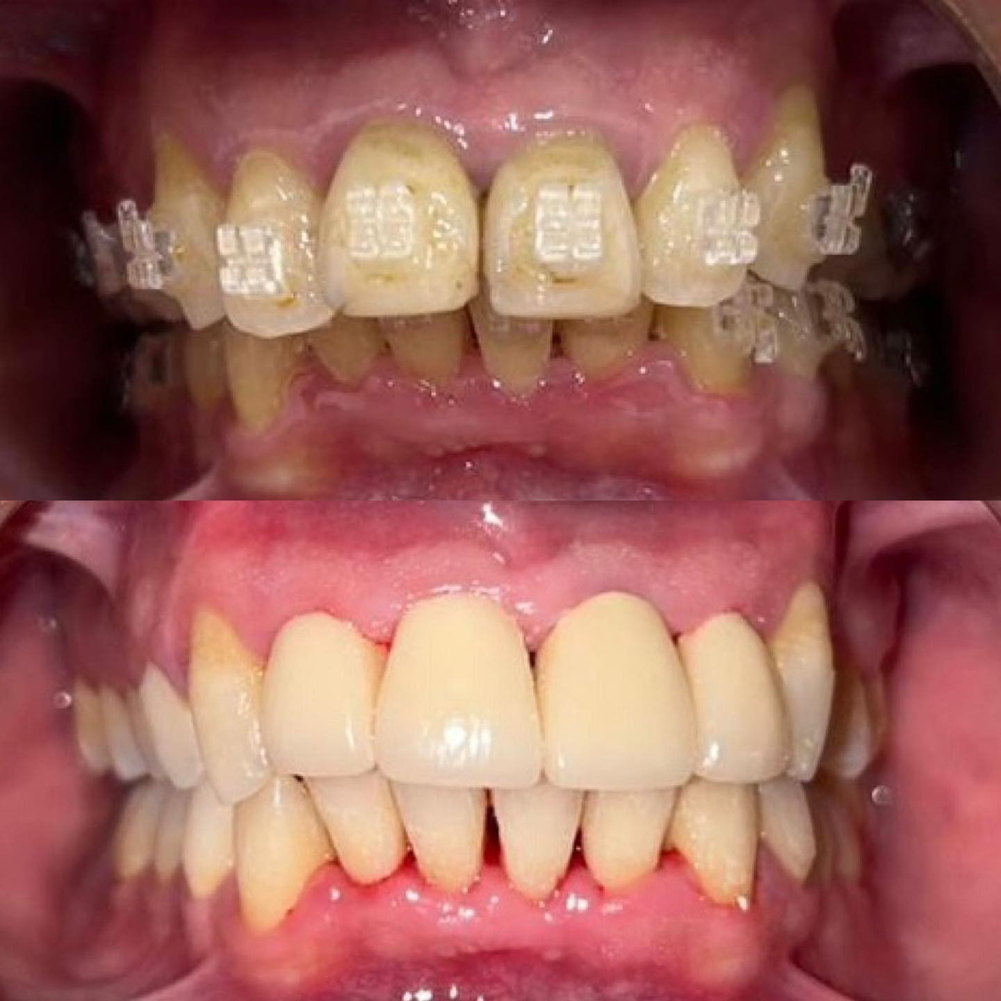 Transformation 6